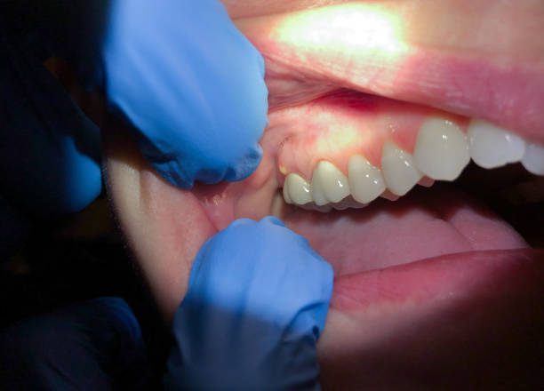Best Emergency Treatment for Toothache in Kimberling City, MO